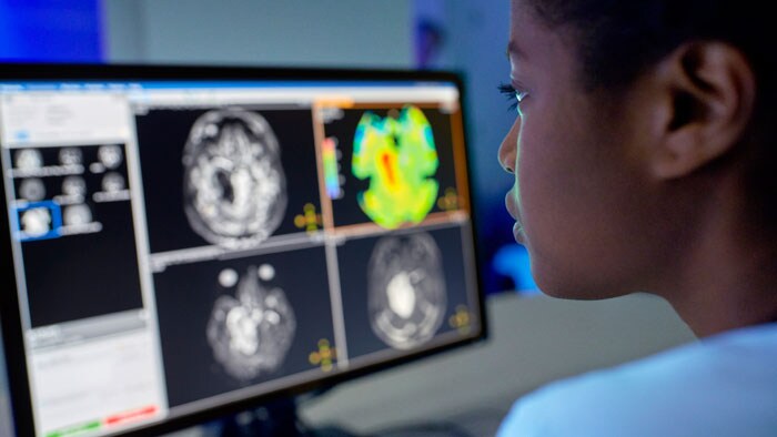 Philips Symposium im Rahmen der DGNR ÖGNR neuroRAD 2025