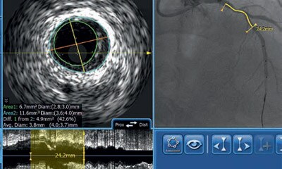 IVUS Workshop