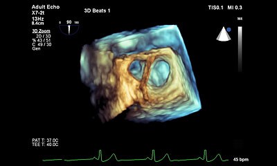 Philips US Weiterbildung Kardiologie