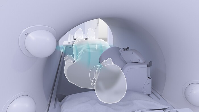 Foto eines Patienten und eines MRT-Systems mit berührungsloser Patientenüberwachung zur Vorbereitung auf einen Scan