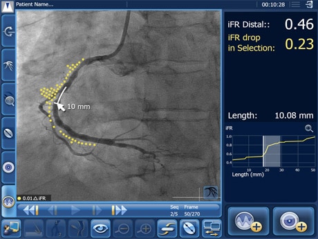 ifr-coreg-overview