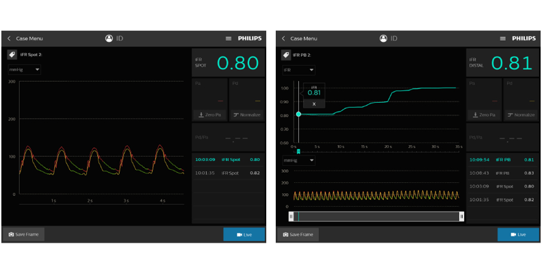 Ifr-Monitor Bild zum Herunterladen (download .png)