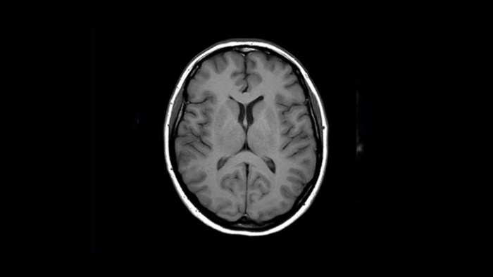 eine Nahaufnahme eines Gehirnscans