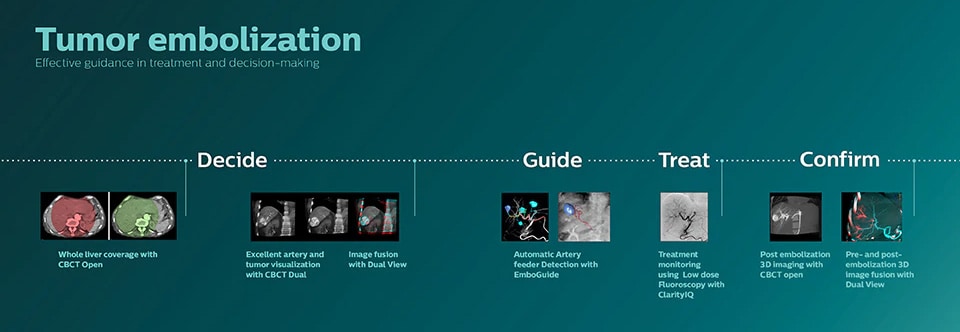 Infografik image