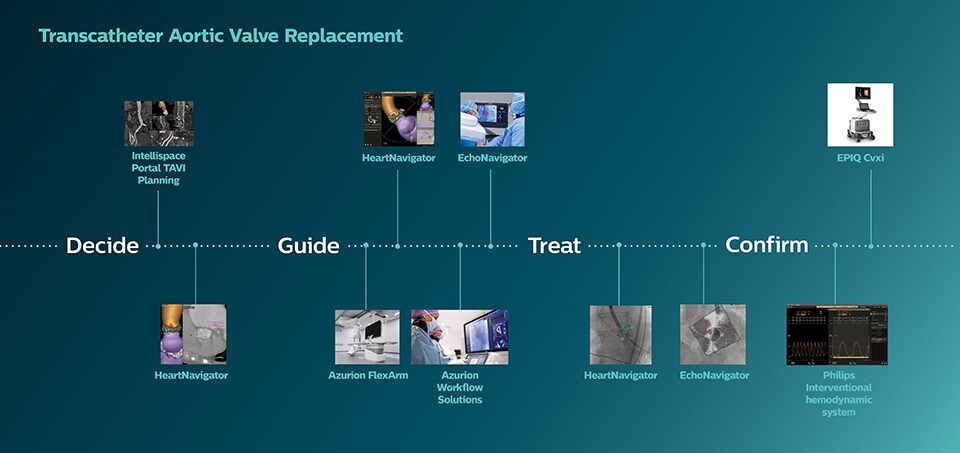 Transkatheter Aortenklappen Implantation