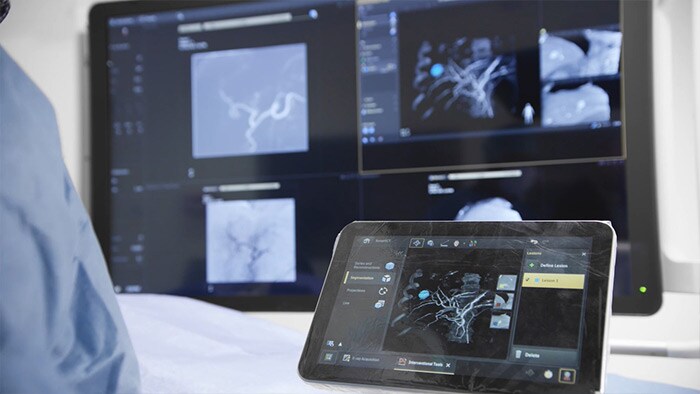 SmartCT 3D-Bildgebung