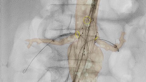 Exklusive Tools für die bildgeführte Chirurgie