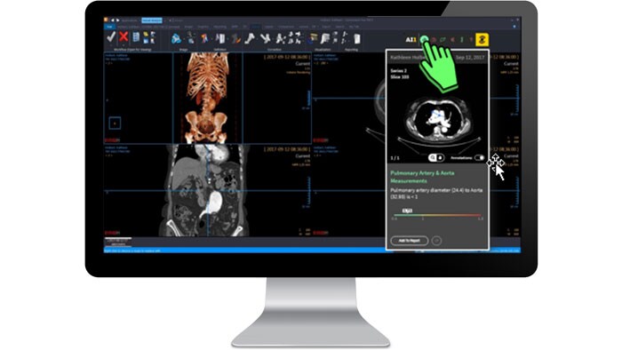 Benutzeroberfläche der klinischen Auswertungen auf einem Monitor