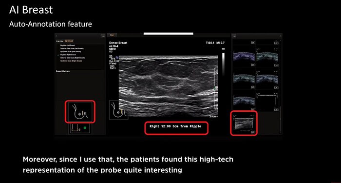 Brustkrebsbehandlungen der Spitzentechnologie