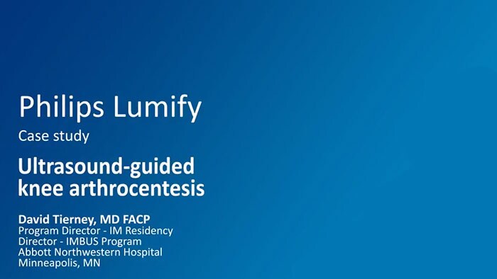 Lumify case study youtube video thumbnail