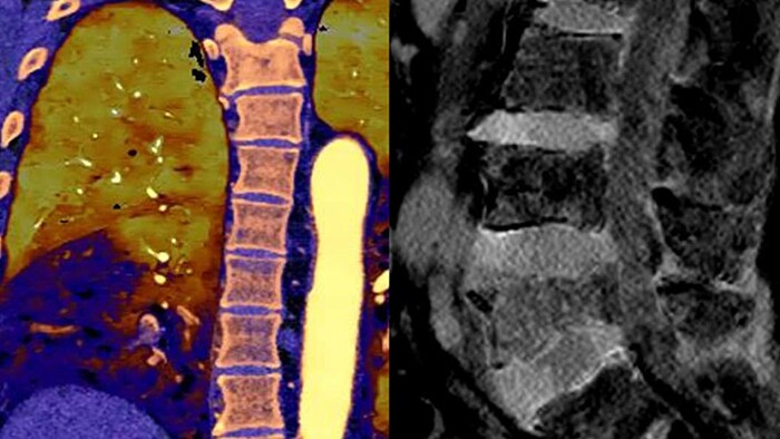 Spektral-CT-Bild