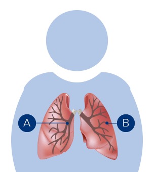 Querschnitt der Lunge