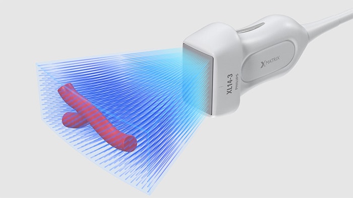 3D/4D-Auflösung in hoher Qualität