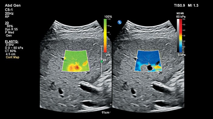 ElastQ Imaging