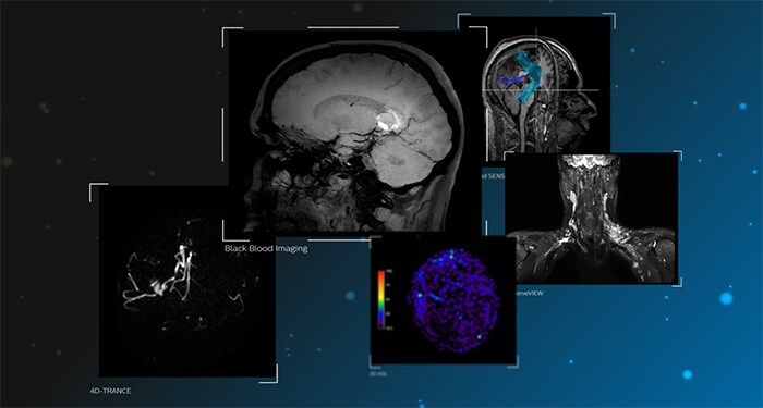 Lösungen für die neurologische Diagnose​