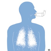 Dosierinhalator mit Kammer