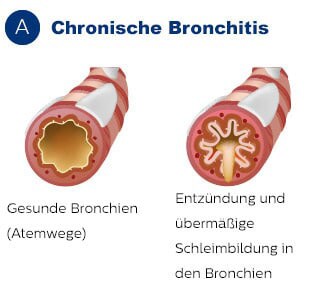 Querschnitt der Bronchien