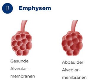 Alveolarmembranen