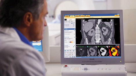 philips iqon spectral ct radiologist