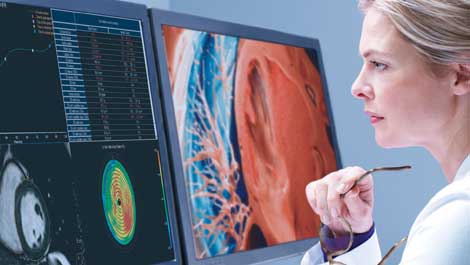 RSNA 2020: Philips präsentiert KI-fähige, automatisierte Radiology Workflow Suite