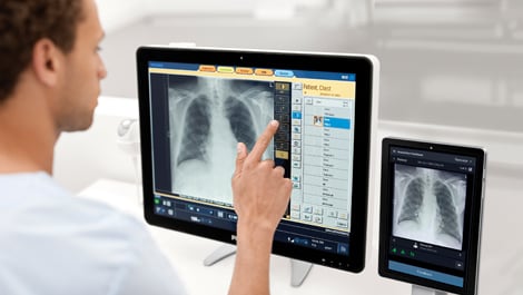 Röntgen mit KI-Unterstützung: Philips bringt Radiology Smart Assistant auf den DACH-Markt