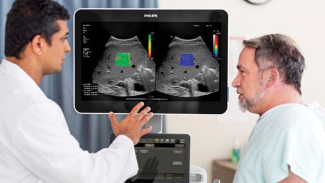 Philips präsentiert neues Tool für die Leberfettquantifizierung per Ultraschall auf dem RSNA 2021