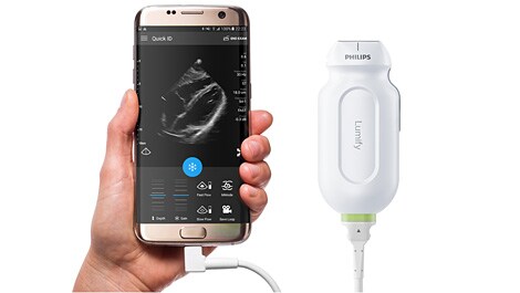 Philips Lumify: Mobiler appbasierter Ultraschall für den Point-of-Care