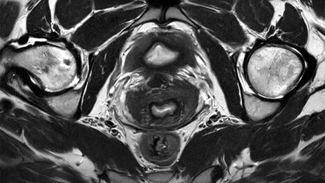 Klinisches Bild des Beckens mit SmartSpeed Precise auf dem Ingenia Evolution System