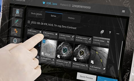 Weltpremiere bei der 92. DGK-Jahrestagung: Philips präsentiert IntraSight Plus – eine Innovation, die Koronarinterventionen erleichtert und die Präzisionsmedizin weiterentwickelt.